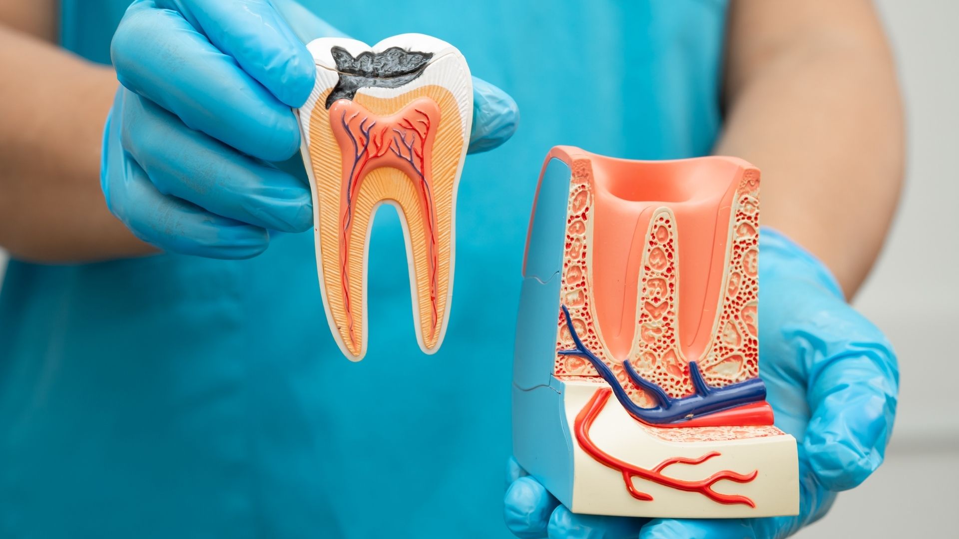 Gentle Root Canal Treatment